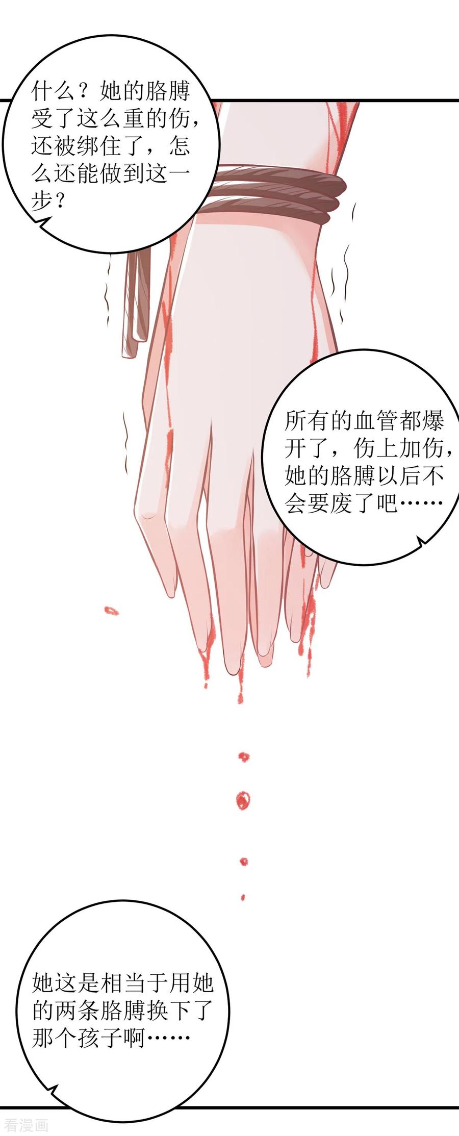 第322话 一个人战斗1