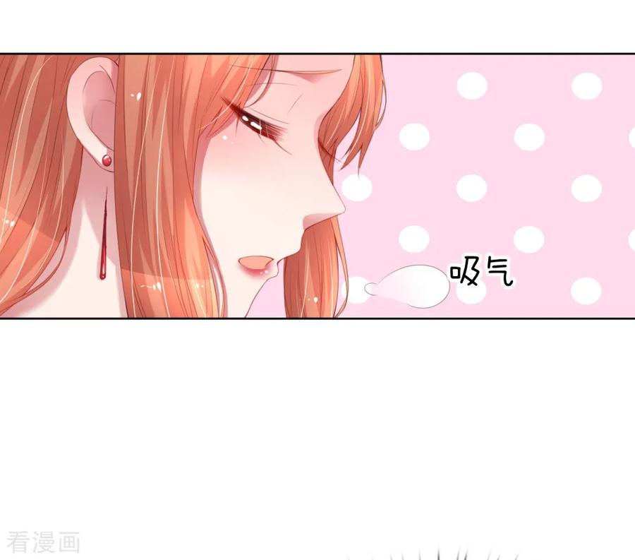 妈咪快跑爹地追来了免费观看漫画,第17话 意外坠马4图